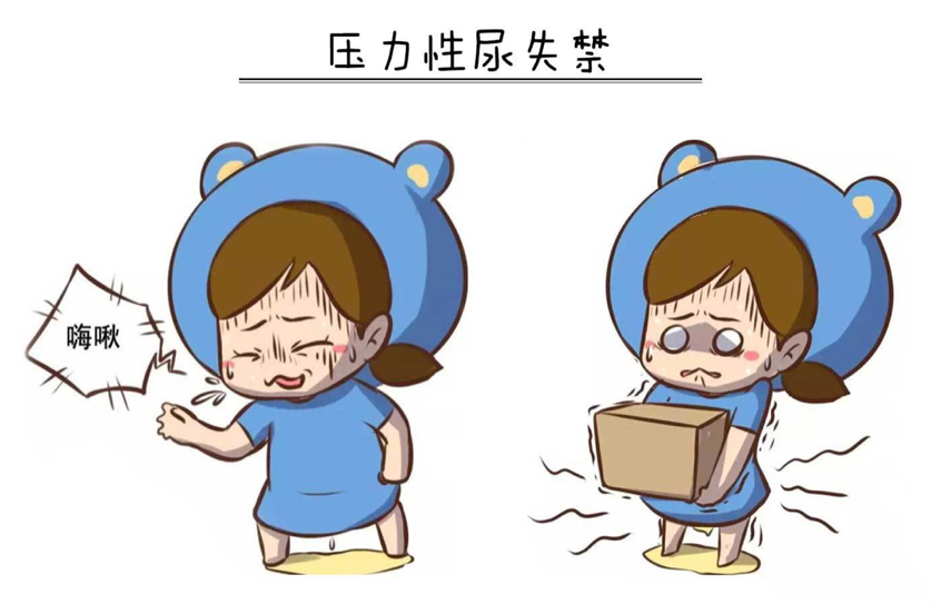 尿道张力过强怎么压力性尿失禁不可怕，三种方法消灭尴尬_https://www.jmylbn.com_新闻资讯_第5张