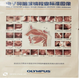 喉镜怎么不能无痛电子鼻咽喉镜检查：耳鼻喉科的“黄金眼”——细软镜体，无痛探查，让疾病无处遁形_https://www.jmylbn.com_新闻资讯_第6张