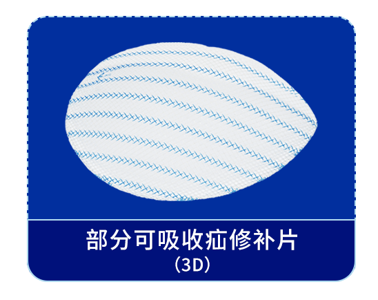 疝补片有什么品牌疝补片集采“末班车”已发动，康蒂娜医疗喊你上车_https://www.jmylbn.com_新闻资讯_第2张