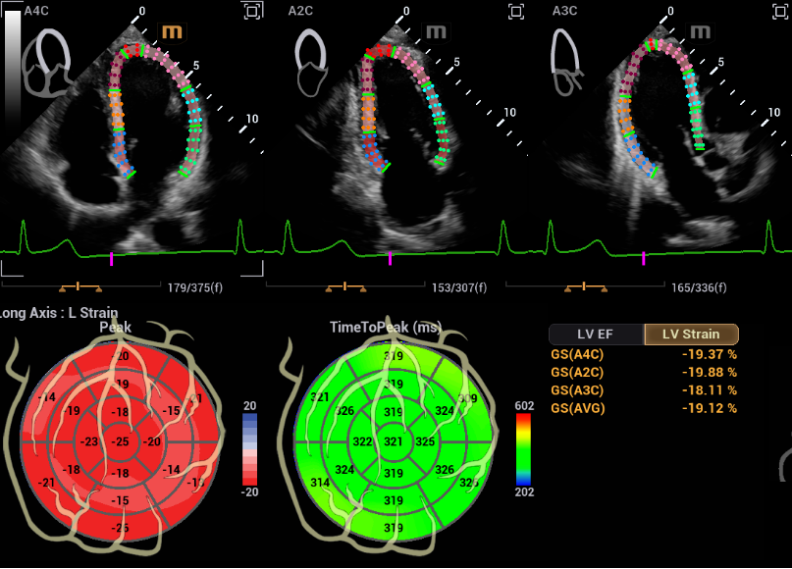 中国哪些医疗设备国产权威发布！2023十大自主创新医疗器械_https://www.jmylbn.com_新闻资讯_第38张