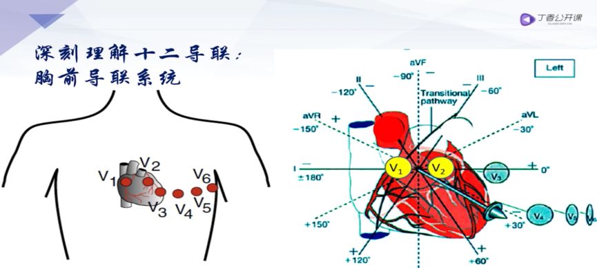 v1在右室流出道,v2右室前壁;v3-4叫移行導聯;v5在腋前線,v6在腋中線