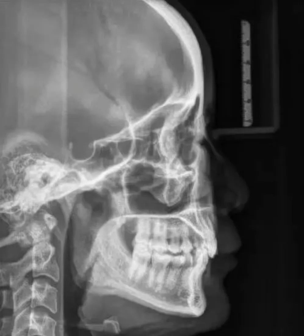 什么牌子口腔ct最好一次口腔CT，看清更多隐患！我院新引进卡瓦口腔三合一CBCT投入使用_https://www.jmylbn.com_新闻资讯_第10张