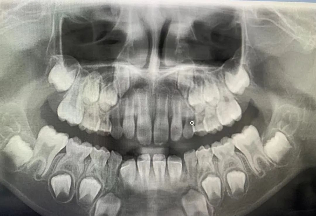 什么牌子口腔ct最好一次口腔CT，看清更多隐患！我院新引进卡瓦口腔三合一CBCT投入使用_https://www.jmylbn.com_新闻资讯_第5张