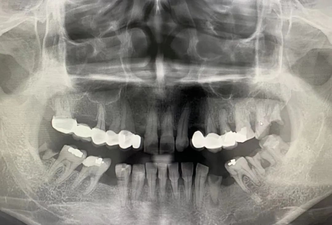 什么牌子口腔ct最好一次口腔CT，看清更多隐患！我院新引进卡瓦口腔三合一CBCT投入使用_https://www.jmylbn.com_新闻资讯_第8张