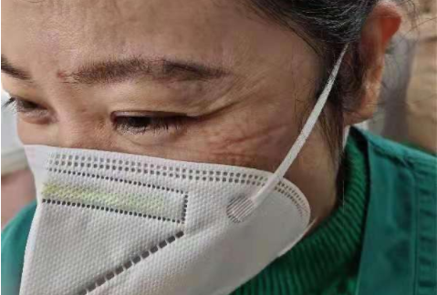 什么口罩防病毒防风防霾防病毒，该选啥子口罩你一定很纠结！_https://www.jmylbn.com_新闻资讯_第39张