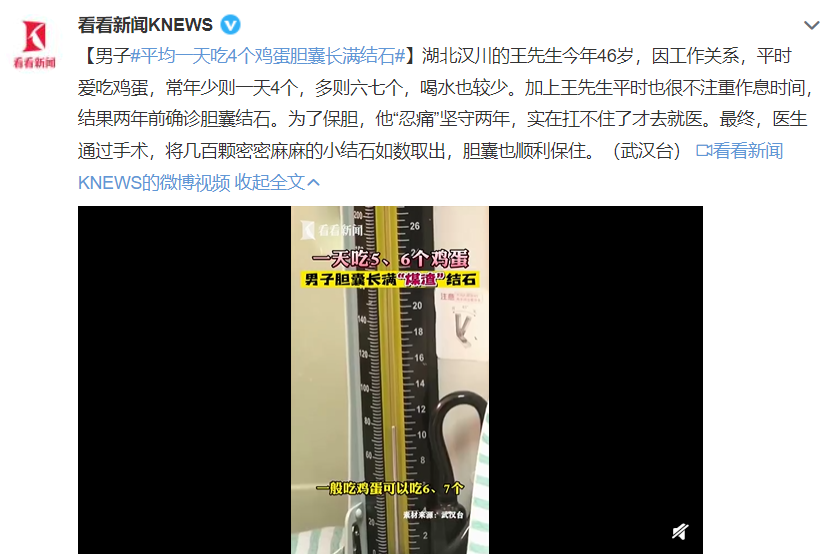 一天吃四个鸡蛋会怎样？过量恐致胆囊结石，这类人群尤其要少吃，每日上限建议明确