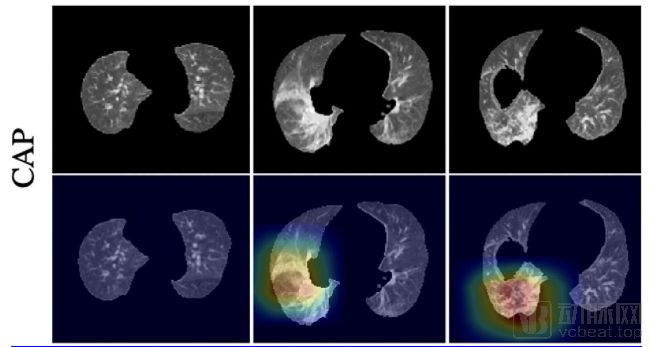 深度學習判別新冠肺炎準確率達九成，《Radiology》已收錄相關研究成果