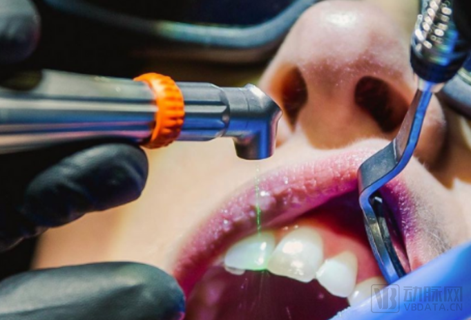 口腔激光有哪些牌子​获5000万美元成长基金，这款二氧化碳激光口腔治疗仪提供无痛无血的舒适化治疗方案【海外案例】_https://www.jmylbn.com_新闻资讯_第4张