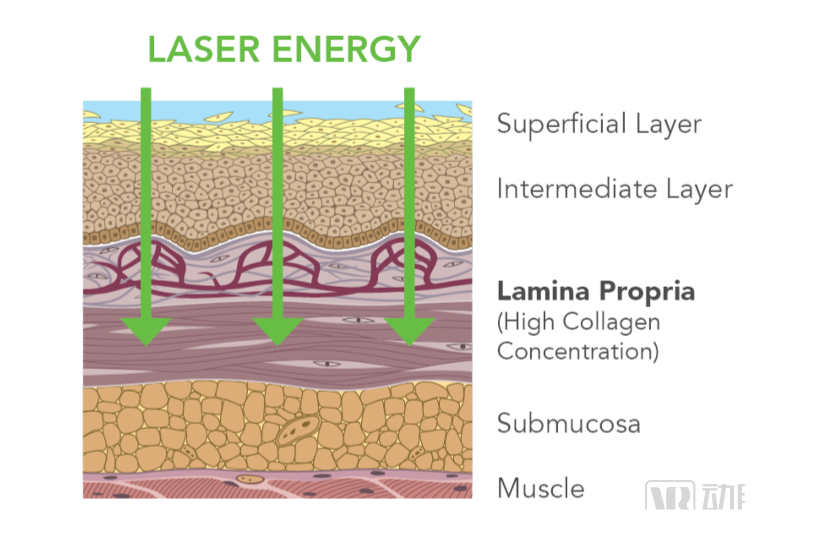 口腔激光有哪些牌子​获5000万美元成长基金，这款二氧化碳激光口腔治疗仪提供无痛无血的舒适化治疗方案【海外案例】_https://www.jmylbn.com_新闻资讯_第10张