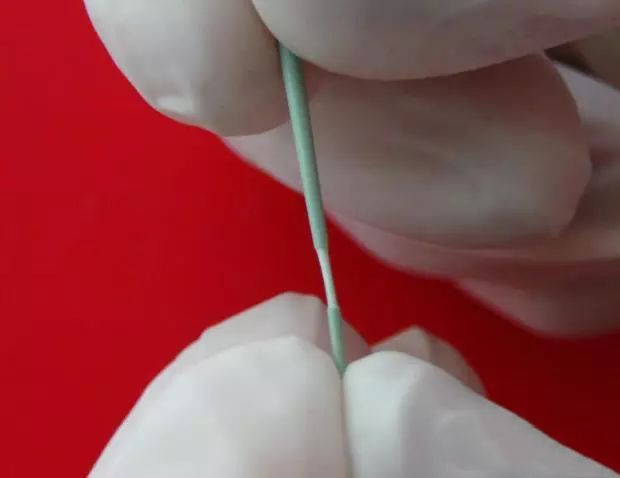 牙胶尖什么颜色正确选择处理主牙胶尖_https://www.jmylbn.com_新闻资讯_第13张