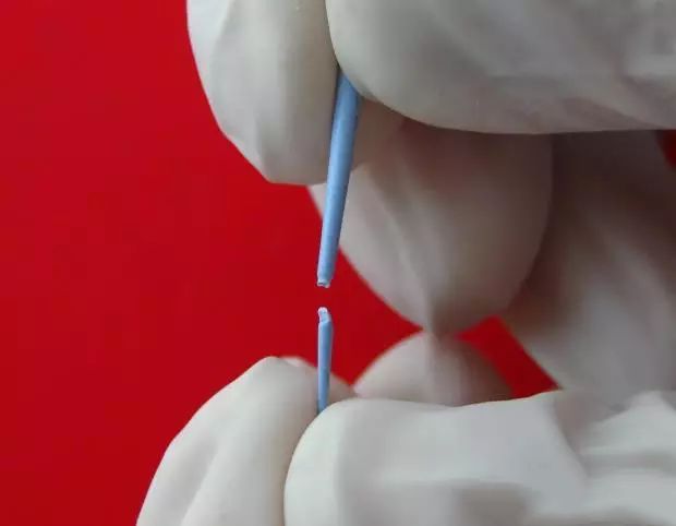 牙胶尖什么颜色正确选择处理主牙胶尖_https://www.jmylbn.com_新闻资讯_第14张