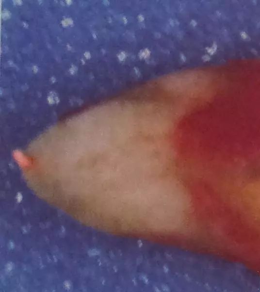 牙胶尖什么颜色正确选择处理主牙胶尖_https://www.jmylbn.com_新闻资讯_第4张