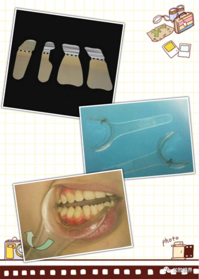 为什么牙医不用开口器What？让牙医在网上看牙？臣妾做不到啊……_https://www.jmylbn.com_新闻资讯_第5张