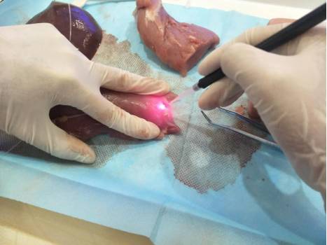 口腔激光怎么治疗谈谈激光在口腔治疗中的华丽现身_https://www.jmylbn.com_新闻资讯_第8张