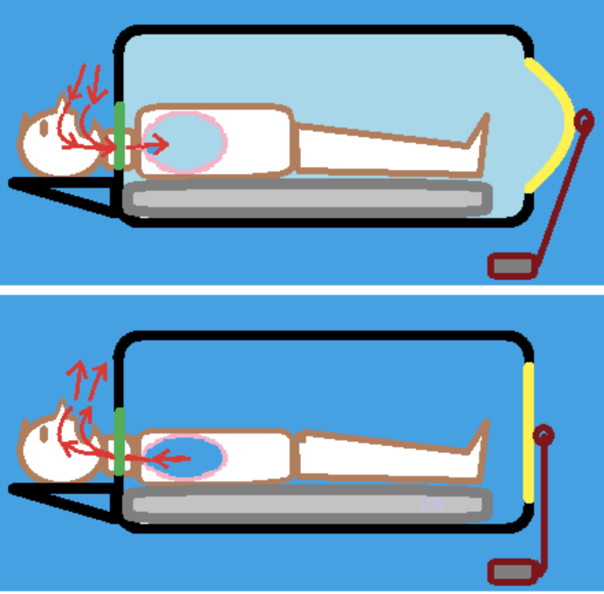 人为什么自动呼吸机​  活在柜子里的人，从铁肺到呼吸机的诞生_https://www.jmylbn.com_新闻资讯_第6张