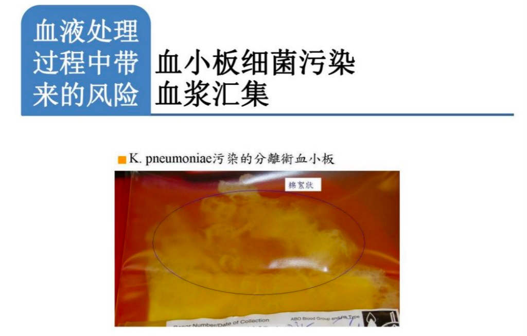 为什么要加热输血科普｜输血传播病原体的灭活技术 1_https://www.jmylbn.com_新闻资讯_第6张