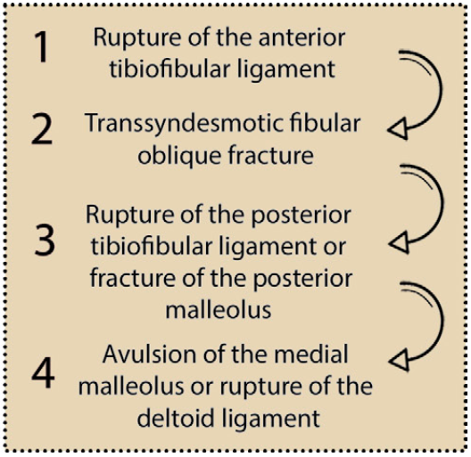 下胫腓联合损伤最全攻略｜解剖、生物力学、影像检查与术后评估