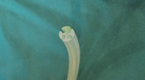 骨科手术伤口引流管被缝住了，怎么办？