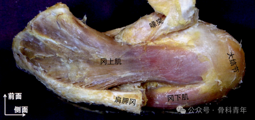 JBJS：关于肱骨大结节骨折，我们应该了解哪些？