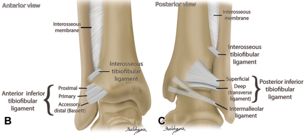 下胫腓联合损伤最全攻略｜解剖、生物力学、影像检查与术后评估