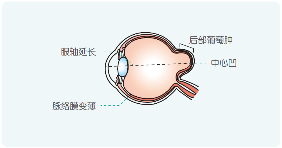儿童保健电脑怎么用《儿童青少年防控近视系列手册》——小学生篇_https://www.jmylbn.com_新闻资讯_第19张