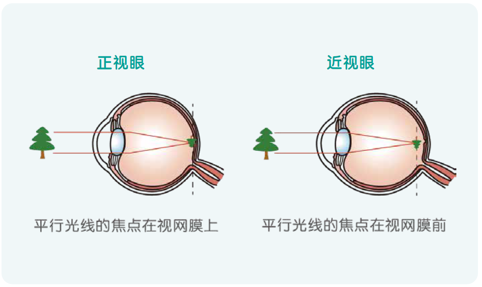 儿童保健电脑怎么用《儿童青少年防控近视系列手册》——小学生篇_https://www.jmylbn.com_新闻资讯_第16张