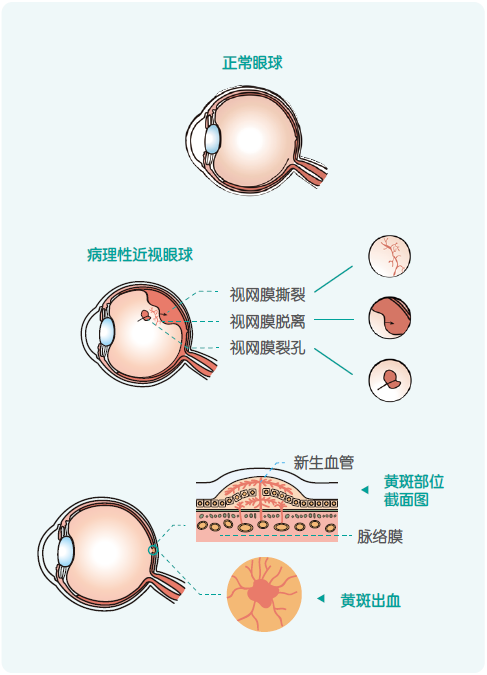 儿童保健电脑怎么用《儿童青少年防控近视系列手册》——小学生篇_https://www.jmylbn.com_新闻资讯_第18张