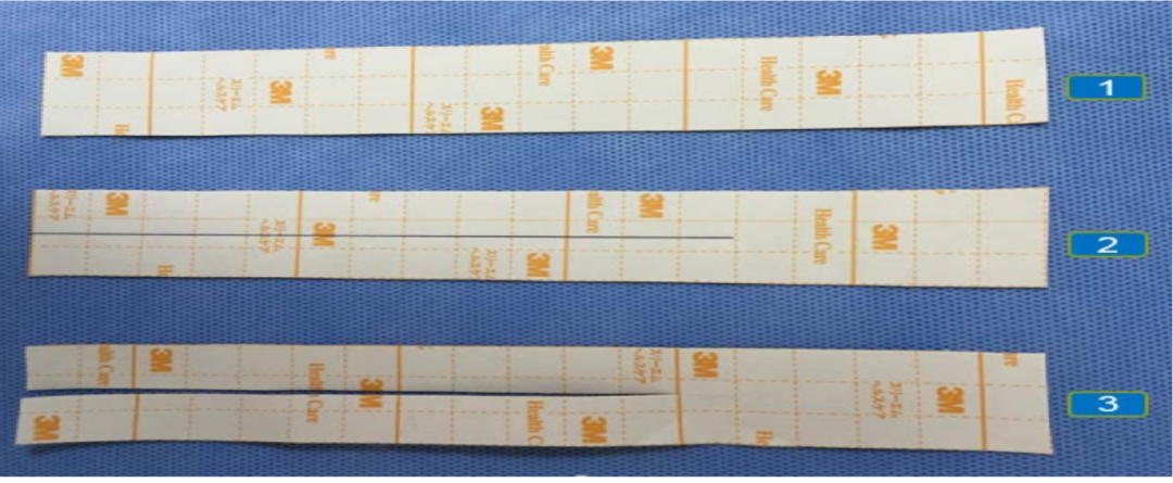 怎么固定引流管常见导管固定，T型、I型、Y型法用起来！_https://www.jmylbn.com_新闻资讯_第4张