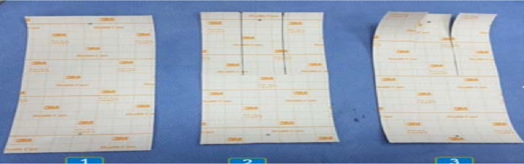 怎么固定引流管常见导管固定，T型、I型、Y型法用起来！_https://www.jmylbn.com_新闻资讯_第11张