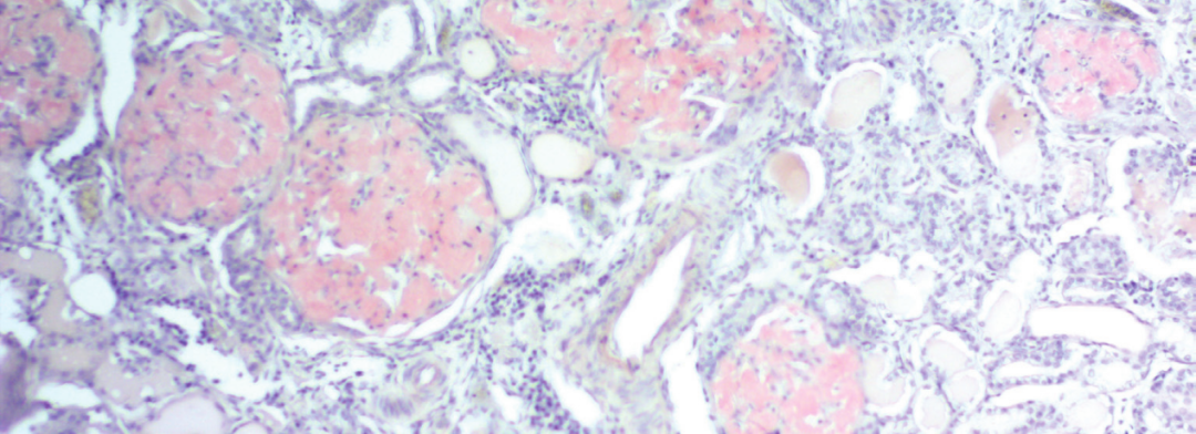 上皮细胞用什么染色组织切片染色方法大全_https://www.jmylbn.com_新闻资讯_第5张