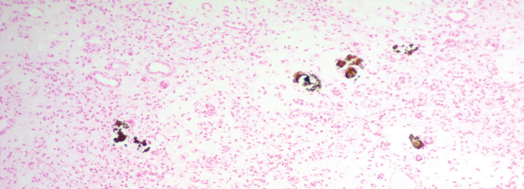 上皮细胞用什么染色组织切片染色方法大全_https://www.jmylbn.com_新闻资讯_第6张