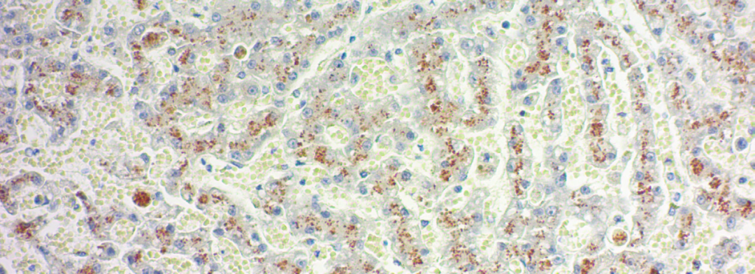上皮细胞用什么染色组织切片染色方法大全_https://www.jmylbn.com_新闻资讯_第13张