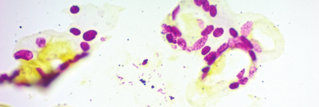 上皮细胞用什么染色组织切片染色方法大全_https://www.jmylbn.com_新闻资讯_第2张