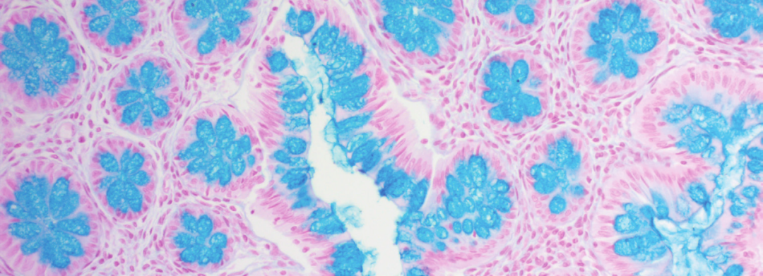 上皮细胞用什么染色组织切片染色方法大全_https://www.jmylbn.com_新闻资讯_第9张