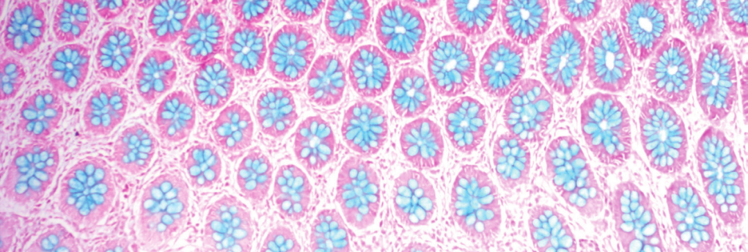 上皮细胞用什么染色组织切片染色方法大全_https://www.jmylbn.com_新闻资讯_第8张