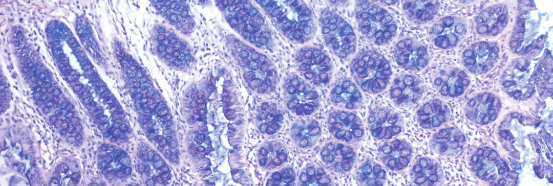 上皮细胞用什么染色组织切片染色方法大全_https://www.jmylbn.com_新闻资讯_第10张