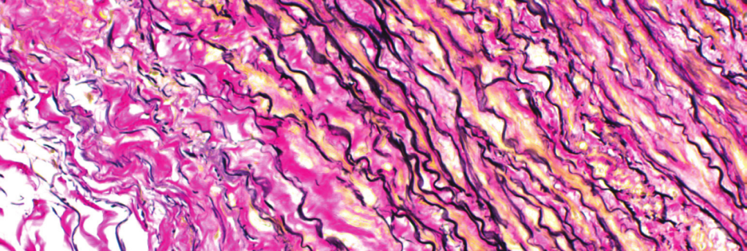 上皮细胞用什么染色组织切片染色方法大全_https://www.jmylbn.com_新闻资讯_第4张