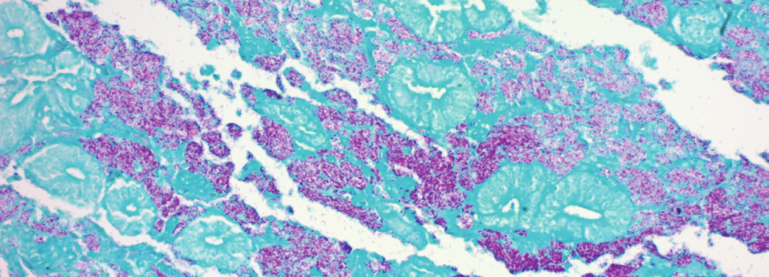 上皮细胞用什么染色组织切片染色方法大全_https://www.jmylbn.com_新闻资讯_第7张