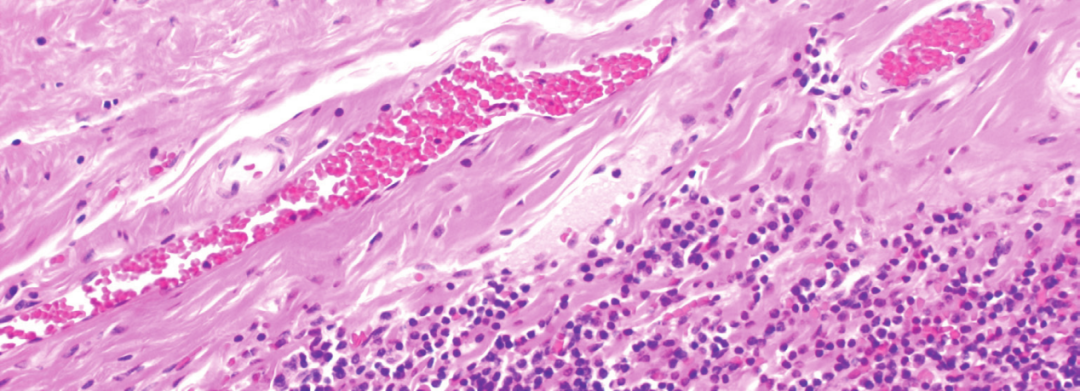 上皮细胞用什么染色组织切片染色方法大全_https://www.jmylbn.com_新闻资讯_第1张