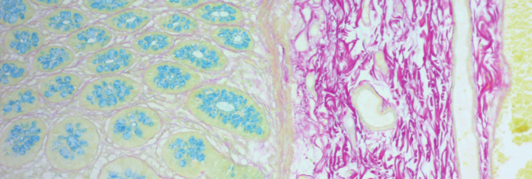 上皮细胞用什么染色组织切片染色方法大全_https://www.jmylbn.com_新闻资讯_第12张