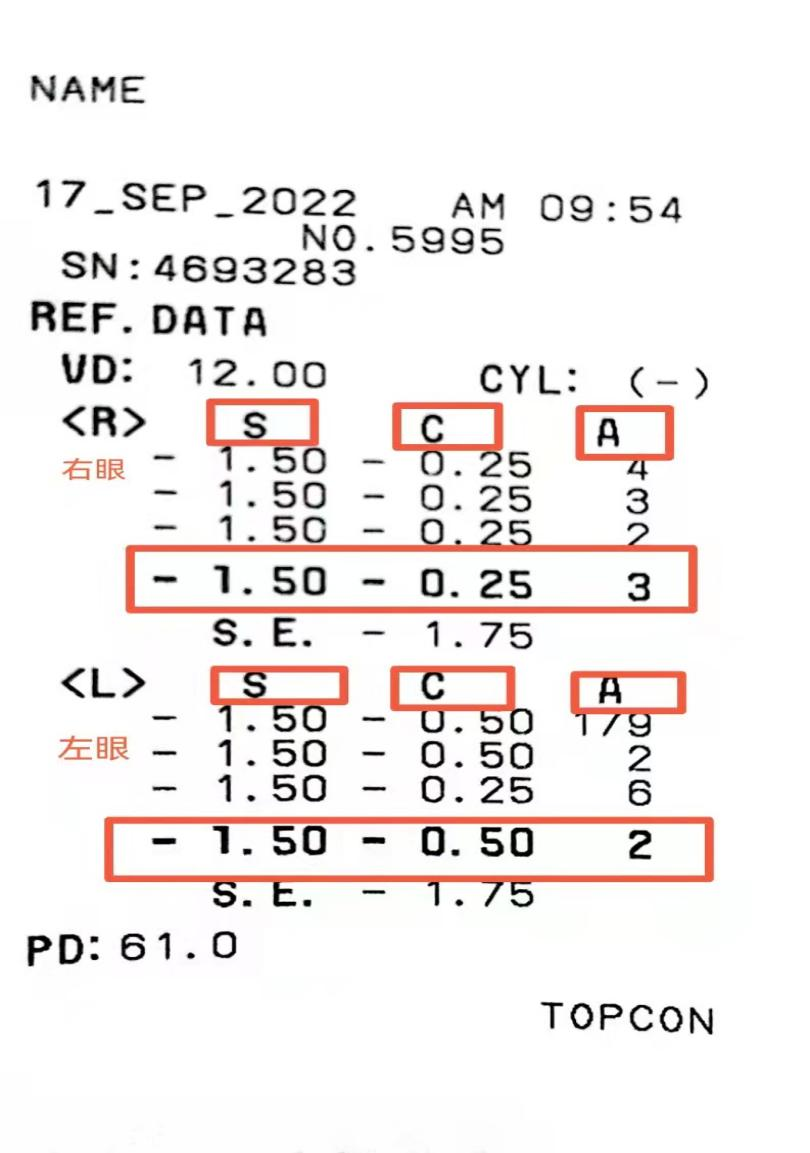 tomey验光怎么看【干货分享】做了视力检查，却看不懂验光单？眼科医生给你说明白！_https://www.jmylbn.com_新闻资讯_第4张