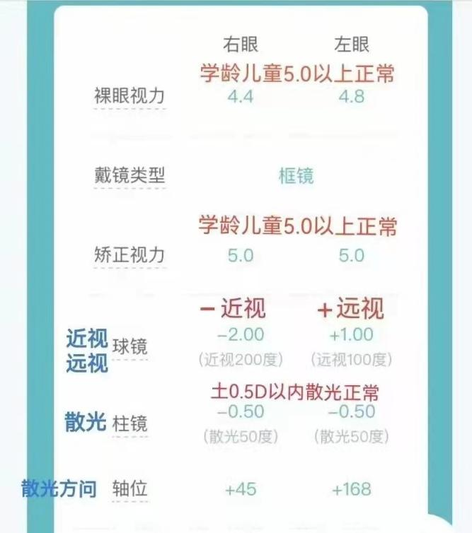 tomey验光怎么看【干货分享】做了视力检查，却看不懂验光单？眼科医生给你说明白！_https://www.jmylbn.com_新闻资讯_第6张