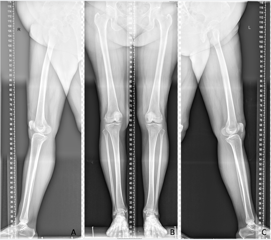 dr数字怎么用数字化X线摄影术（DR）_https://www.jmylbn.com_新闻资讯_第8张
