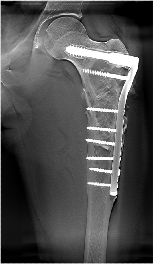 dr数字怎么用数字化X线摄影术（DR）_https://www.jmylbn.com_新闻资讯_第6张