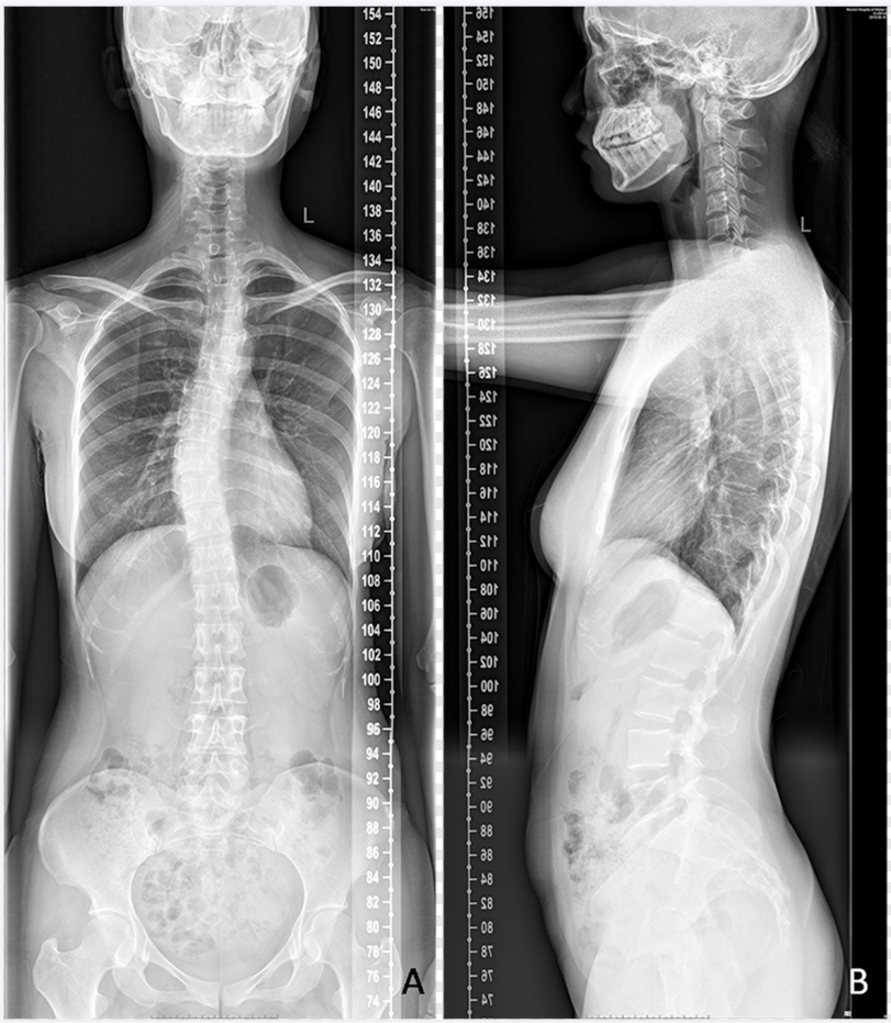 dr数字怎么用数字化X线摄影术（DR）_https://www.jmylbn.com_新闻资讯_第7张