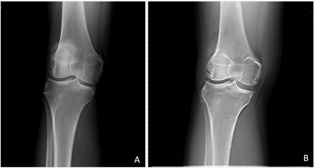 dr数字怎么用数字化X线摄影术（DR）_https://www.jmylbn.com_新闻资讯_第3张