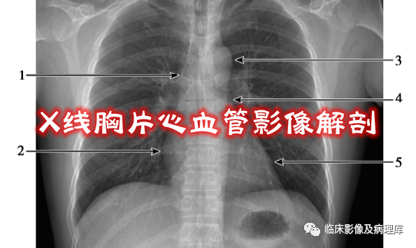 ero为什么不显示二尖瓣关闭不全CT表现_https://www.jmylbn.com_新闻资讯_第3张