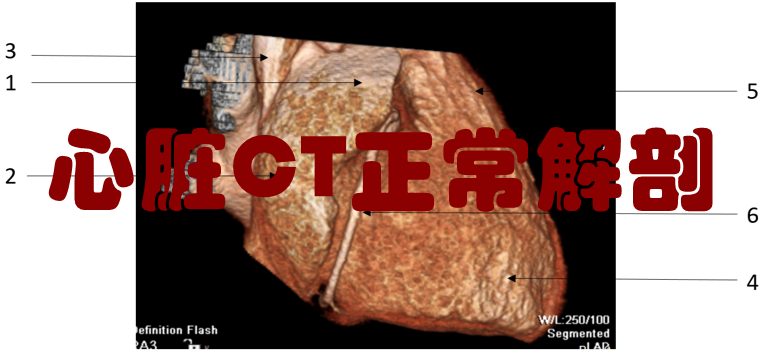 ero为什么不显示二尖瓣关闭不全CT表现_https://www.jmylbn.com_新闻资讯_第2张