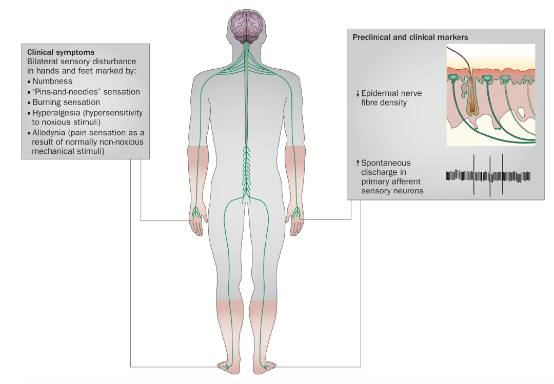 項目進(jìn)展 | 本草瑞生FIC創(chuàng  )新藥ricolinostat IND獲CDE受理，推進(jìn)新適應癥CIPN中國開(kāi)發(fā)