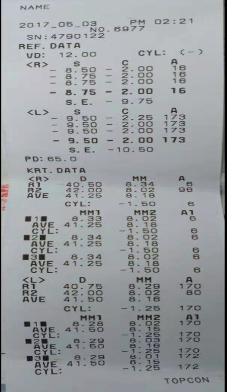 电脑验光器怎么用又一“利器”—哈市五院眼科新设备进口综合验光仪投入使用_https://www.jmylbn.com_新闻资讯_第6张